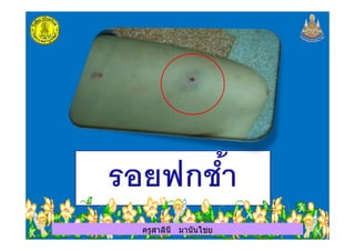 ครูสาลินี มานันไชยครูสาลินี มานันไชย
 