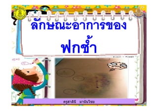 ครูสาลินี มานันไชยครูสาลินี มานันไชย
 