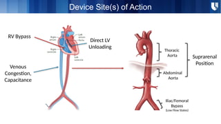 Devices in the Management of Acute Heart Failure (or) Cardiogenic Shock ...