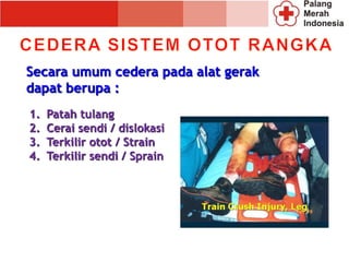 Secara umum cedera pada alat gerak
dapat berupa :
1. Patah tulang
2. Cerai sendi / dislokasi
3. Terkilir otot / Strain
4. Terkilir sendi / Sprain
 
