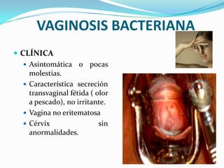 VAGINOSIS BACTERIANA
 CLÍNICA
    Asintomática o pocas
     molestias.
    Característica secreción
     transvaginal fétida ( olor
     a pescado), no irritante.
    Vagina no eritematosa
    Cérvix                 sin
     anormalidades.
 