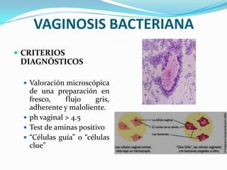 VAGINOSIS BACTERIANA
 CRITERIOS
 DIAGNÓSTICOS

   Valoración microscópica
    de una preparación en
    fresco,    flujo     gris,
    adherente y maloliente.
   ph vaginal > 4.5
   Test de aminas positivo
   “Células guía” o “células
    clue”
 