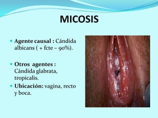 MICOSIS
 Agente causal : Cándida
 albicans ( + fcte – 90%).

 Otros agentes :
  Cándida glabrata,
  tropicalis.
 Ubicación: vagina, recto
  y boca.
 