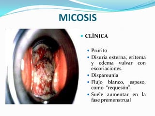 MICOSIS
    CLÍNICA

      Prurito
      Disuria externa, eritema
       y edema vulvar con
       excoriaciones.
      Dispareunia
      Flujo blanco, espeso,
       como “requesón”.
      Suele aumentar en la
       fase premenstrual
 