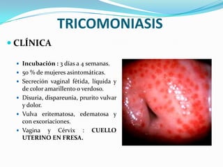 TRICOMONIASIS
 CLÍNICA

  Incubación : 3 días a 4 semanas.
  50 % de mujeres asintomáticas.
  Secreción vaginal fétida, líquida y
   de color amarillento o verdoso.
  Disuria, dispareunia, prurito vulvar
   y dolor.
  Vulva eritematosa, edematosa y
   con excoriaciones.
  Vagina y Cérvix : CUELLO
   UTERINO EN FRESA.
 