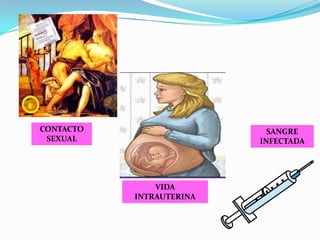 CONTACTO                    SANGRE
 SEXUAL                   INFECTADA




               VIDA
           INTRAUTERINA
 