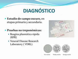 DIAGNÓSTICO
 Estudio de campo oscuro, en
 etapas primaria y secundaria.

 Pruebas no treponémicas:
    Reagina plasmática rápida
     (RPR)
    Veneral Disease Research
     Laboratory ( VDRL).
 