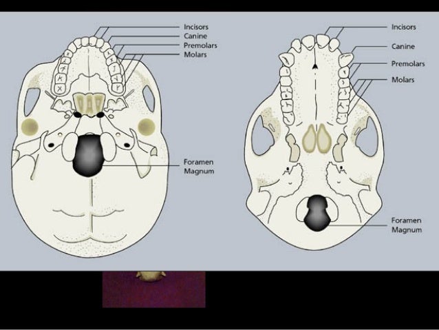 gorilla skull mastoid process gorilla skull mastoid process