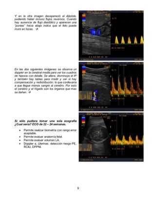 9
Y en la otra imagen desapareció el diástole,
pudiendo haber incluso flujos reversos. Cuando
hay ausencia de flujo diastólico y aparecen una
“puntas” hacia abajo indica que el feto puede
morir en horas. 
En las dos siguientes imágenes se observa un
doppler en la cerebral media para ver los cuadros
de hipoxia con detalle. Se altera, disminuye el IP
y también hay tablas para medir y ver si hay
compensación y redistribución, lo que conllevaría
a que llegue menos sangre al cerebro. Por esto
el cerebro y el hígado son los órganos que mas
se dañan. 
Si sólo pudiera tomar una sola ecografía
¿Cual sería? ECO de 22 – 24 semanas.
 Permite realizar biometría con rango error
aceptable.
 Permite evaluar anatomía fetal.
 Permite evaluar volumen LA.
 Doppler a. Uterinas: detección riesgo PE,
RCIU, DPPNI.
 