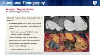 Noninvasive Assessment of Right Ventricle and Tricuspid Valve | PDF