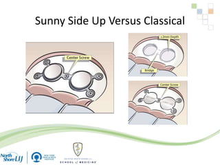 Sunny Side Up Versus Classical
 