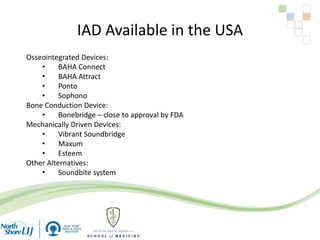 IAD Available in the USA
Osseointegrated Devices:
• BAHA Connect
• BAHA Attract
• Ponto
• Sophono
Bone Conduction Device:
• Bonebridge – close to approval by FDA
Mechanically Driven Devices:
• Vibrant Soundbridge
• Maxum
• Esteem
Other Alternatives:
• Soundbite system
 