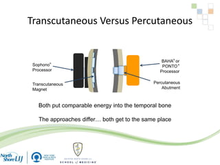 Transcutaneous Versus Percutaneous
BAHA®
or
PONTO®
Processor
Percutaneous
Abutment
Sophono®
Processor
Transcutaneous
Magnet
Both put comparable energy into the temporal bone
The approaches differ… both get to the same place
 