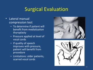 Surgical Evaluation
• Lateral manual
compression test
– To determine if patient will
benefit from medialization
thyroplasty
– Pressure applied at level of
vocal cords
– If quality of speech
improves with pressure,
patient will benefit from
procedure
– Limitations: older patients,
scarred vocal cords
40
 