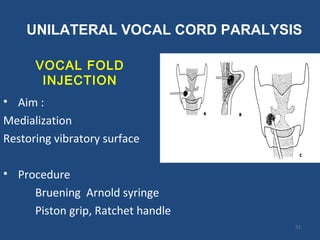 VOCAL FOLD
INJECTION
• Aim :
Medialization
Restoring vibratory surface
• Procedure
Bruening Arnold syringe
Piston grip, Ratchet handle
UNILATERAL VOCAL CORD PARALYSIS
51
 