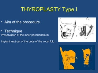 THYROPLASTY Type I
• Aim of the procedure
• Technique
Preservation of the inner perichondrium
Implant kept out of the body of the vocal fold
52
 