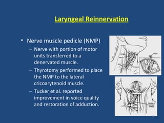 Laryngeal Reinnervation
• Nerve muscle pedicle (NMP)
– Nerve with portion of motor
units transferred to a
denervated muscle.
– Thyrotomy performed to place
the NMP to the lateral
cricoarytenoid muscle.
– Tucker et al. reported
improvement in voice quality
and restoration of adduction.
59
 