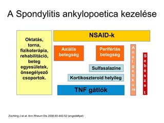 Oktatás,
torna,
fizikoterápia,
rehabilitáció,
beteg
egyesületek,
önsegélyező
csoportok.
NSAID-k
Perifériás
betegség
Axiális
betegség
Sulfasalazine
TNF gátlók
A
n
a
l
g
e
ti
k
u
m
Kortikoszteroid helyileg
S
e
b
é
s
z
e
t
Zochling J et al. Ann Rheum Dis 2006;65:442-52 (engedéllyel)
A Spondylitis ankylopoetica kezelése
 