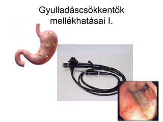 Gyulladáscsökkentők
mellékhatásai I.
 