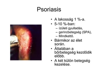 Psoriasis
• A lakosság 1 %-a.
• 5-10 %-ban:
– ízületi gyulladás,
– gerincbetegség (SPA),
– Mindkettő.
• Bármikor az élet
során.
• Általában a
bőrbetegség kezdődik
előbb.
• A két külön betegség
kezelése.
 