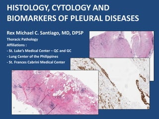 HISTOLOGY, CYTOLOGY AND
BIOMARKERS OF PLEURAL DISEASES
Rex Michael C. Santiago, MD, DPSP
Thoracic Pathology
Affiliations :
- St. Luke’s Medical Center – QC and GC
- Lung Center of the Philippines
- St. Frances Cabrini Medical Center
 