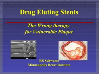 Drug Eluting Stents
The Wrong therapy
for Vulnerable Plaque
RS Schwartz
Minneapolis Heart Institute
 