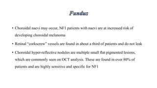 • Choroidal naevi may occur, NF1 patients with naevi are at increased risk of
developing choroidal melanoma
• Retinal “corkscrew” vessels are found in about a third of patients and do not leak
• Choroidal hyper-reflective nodules are multiple small flat pigmented lesions,
which are commonly seen on OCT analysis. These are found in over 80% of
patients and are highly sensitive and specific for NF1
 