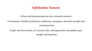 Ophthalmic features
Ptosis and hypermetropia are also extremely common.
Uncommon. Motility dysfunction (strabismus, nystagmus, abnormal saccades and
smooth pursuit),
light–near dissociation, iris vascular tufts, mild pigmentary retinopathy, optic
atrophy and hypotony.
 
