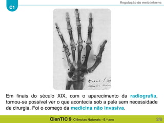 Regulação do meio interno
C1
CienTIC 9 Ciências Naturais - 9.o ano
Em finais do século XIX, com o aparecimento da radiografia,
tornou-se possível ver o que acontecia sob a pele sem necessidade
de cirurgia. Foi o começo da medicina não invasiva.
2/8
 