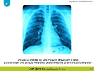 Regulação do meio interno
C1
CienTIC 9 Ciências Naturais - 9.o ano 3/8
Os raios X emitidos por uma máquina atravessam o corpo
para atingirem uma película fotográfica, criando imagens de sombra, as radiografias.
 
