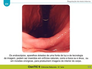 Regulação do meio interno
C1
CienTIC 9 Ciências Naturais - 9.o ano 5/8
Os endoscópios, aparelhos dotados de uma fonte de luz e de tecnologia
de imagem, podem ser inseridos em orifícios naturais, como a boca ou o ânus, ou
em incisões cirúrgicas, para produzirem imagens do interior do corpo.
 