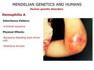 MENDELIAN GENETICS AND HUMANS
Human genetic disorders

Hemophilia A
Inheritance Pattern:
-X-linked recessive
Physical Effects:
-Excessive bleeding from minor
cuts
-Extensive bruises

 