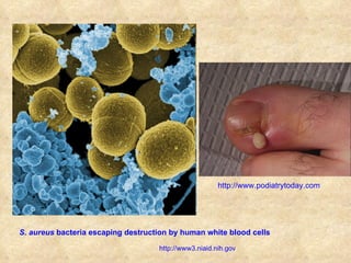 S. aureus  bacteria escaping destruction by human white blood cells   http://www3.niaid.nih.gov http://www.podiatrytoday.com 