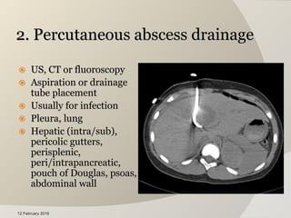 07 radiology in surgery tutorial hajhamad m msu | PPTX
