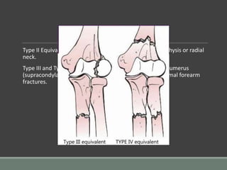 paediatric injuries around the elbow. | PPTX