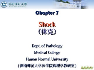 07 shock | PPT
