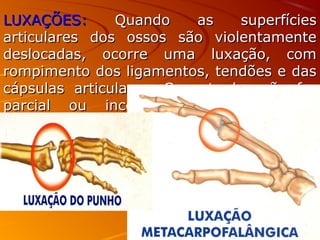 LUXAÇÕES:LUXAÇÕES: Quando as superfíciesQuando as superfícies
articulares dos ossos são violentamentearticulares dos ossos são violentamente
deslocadas, ocorre uma luxação, comdeslocadas, ocorre uma luxação, com
rompimento dos ligamentos, tendões e dasrompimento dos ligamentos, tendões e das
cápsulas articulares. Se esta luxação forcápsulas articulares. Se esta luxação for
parcial ou incompleta é denomidadaparcial ou incompleta é denomidada
subluxação.subluxação.
 