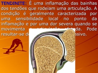 TENDINITE:TENDINITE: É uma inflamação das bainhasÉ uma inflamação das bainhas
dos tendões que rodeiam uma articulação. Ados tendões que rodeiam uma articulação. A
condição é geralmente caracterizada porcondição é geralmente caracterizada por
uma sensibilidade local no ponto dauma sensibilidade local no ponto da
inflamação e por uma dor severa quando seinflamação e por uma dor severa quando se
movimenta a articulação afetada. Podemovimenta a articulação afetada. Pode
resultar-se de trauma ou uso excessivo.resultar-se de trauma ou uso excessivo.
 