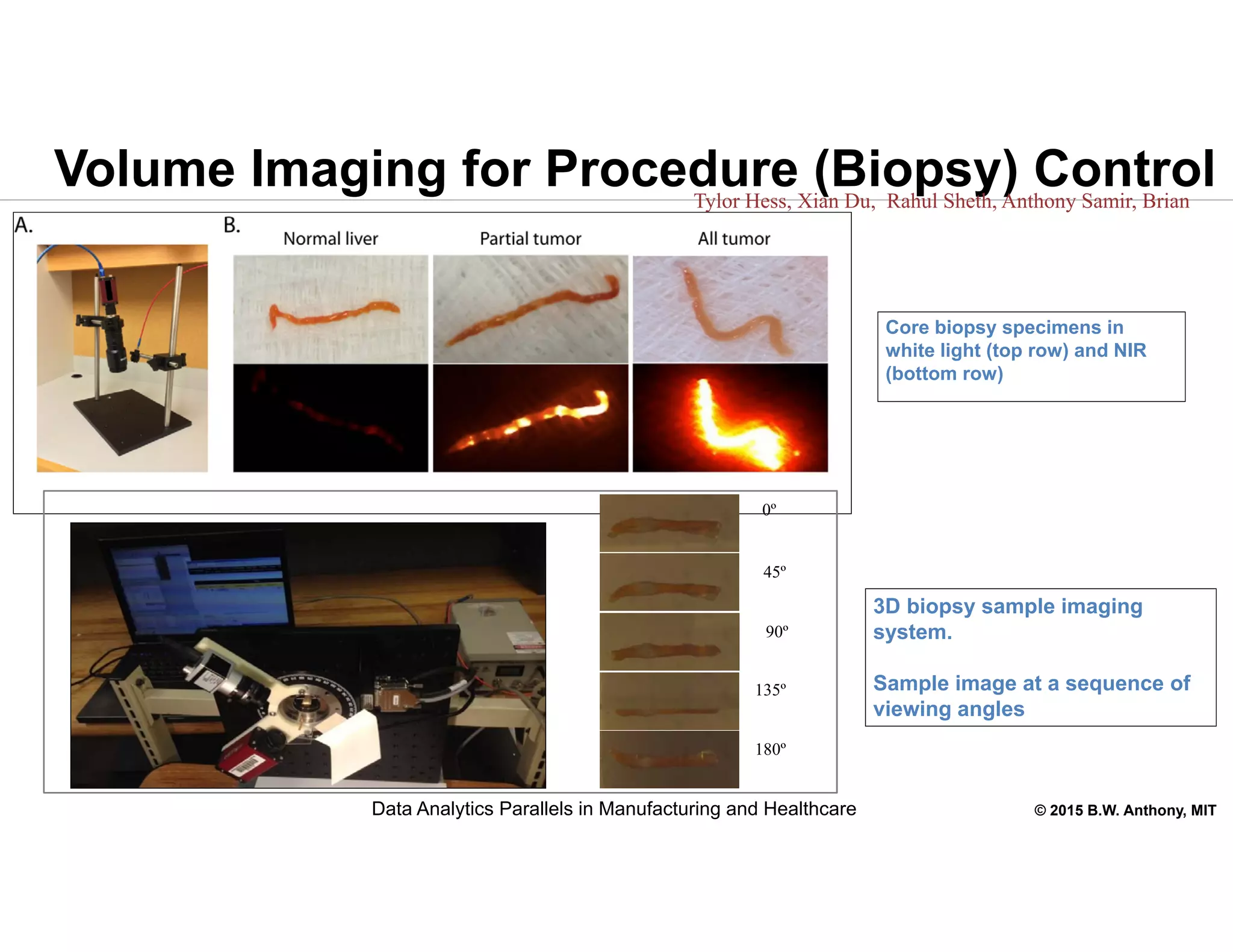 © 2015 B.W. Anthony, MIT
Volume Imaging for Procedure (Biopsy) ControlTylor Hess, Xian Du, Rahul Sheth, Anthony Samir, Brian
Anthony
Core biopsy specimens in
white light (top row) and NIR
(bottom row)
3D biopsy sample imaging
system.
Sample image at a sequence of
viewing angles
0º
45º
90º
135º
180º
Data Analytics Parallels in Manufacturing and Healthcare
 
