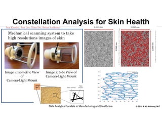 © 2015 B.W. Anthony, MIT
Constellation Analysis for Skin Health
Mechanical scanning system to take
high resolutions images of skin
Image 1: Isometric View 
of
Camera‐Light Mount
Image 2: Side View of
Camera‐Light Mount
Ina Kundu, Ian Lee, Xian Du, Brian Anthony
Data Analytics Parallels in Manufacturing and Healthcare
 