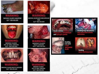 Si bien todos intervienen en los procesos de adicción a distintas drogas, en la ADICCIÓN A LA NICOTINA  tiene principal importancia el Sistema Mesolímbico Dopaminérgico, Síndrome de Abstinencia  interviene el Locus Ceruleus y el Sistema de la Norepinefrina.
