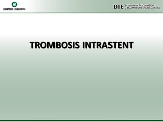 TROMBOSIS INTRASTENT

 