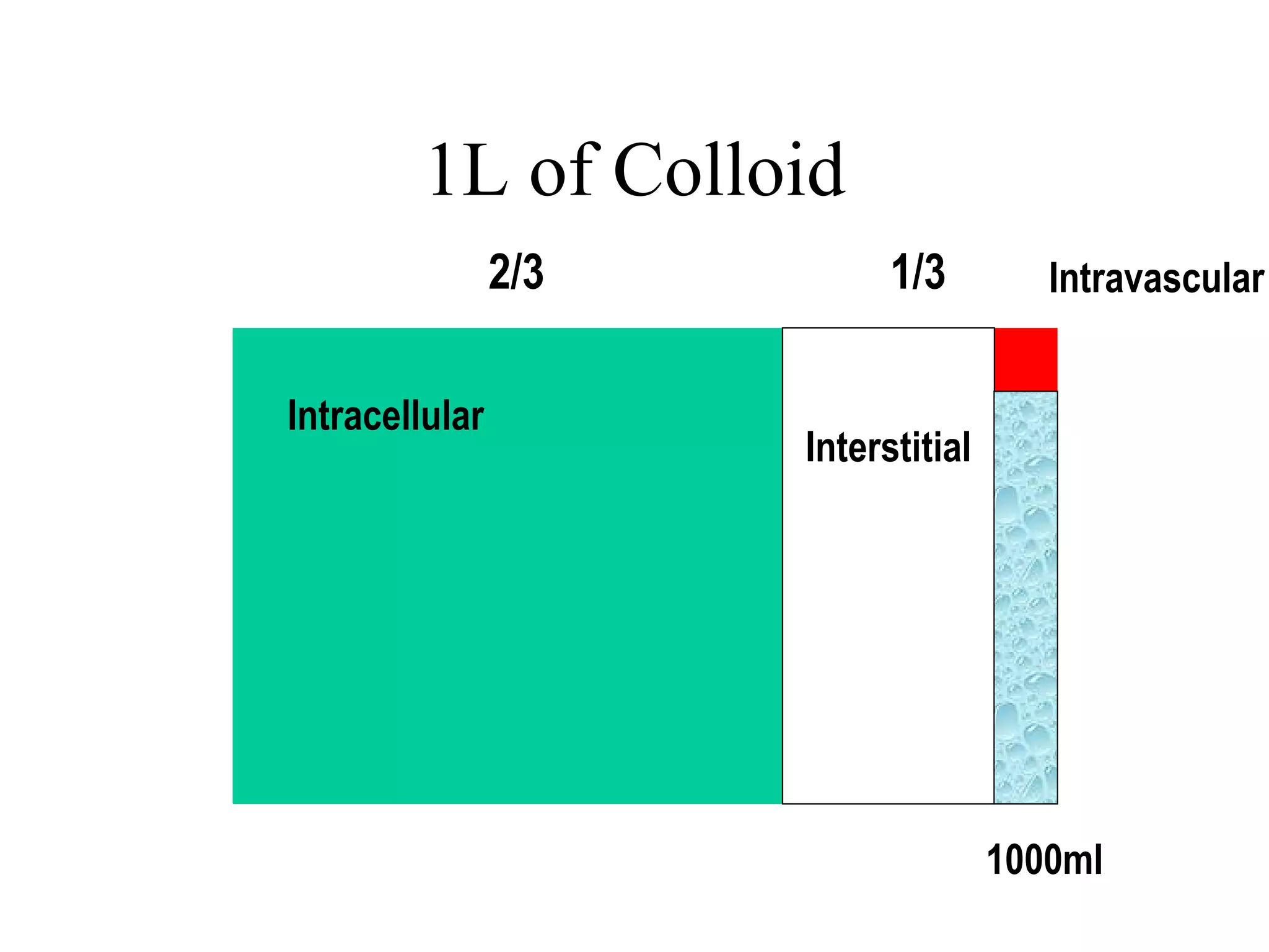 1L of Colloid
Intracellular
Interstitial
Intravascular2/3 1/3
1000ml
 