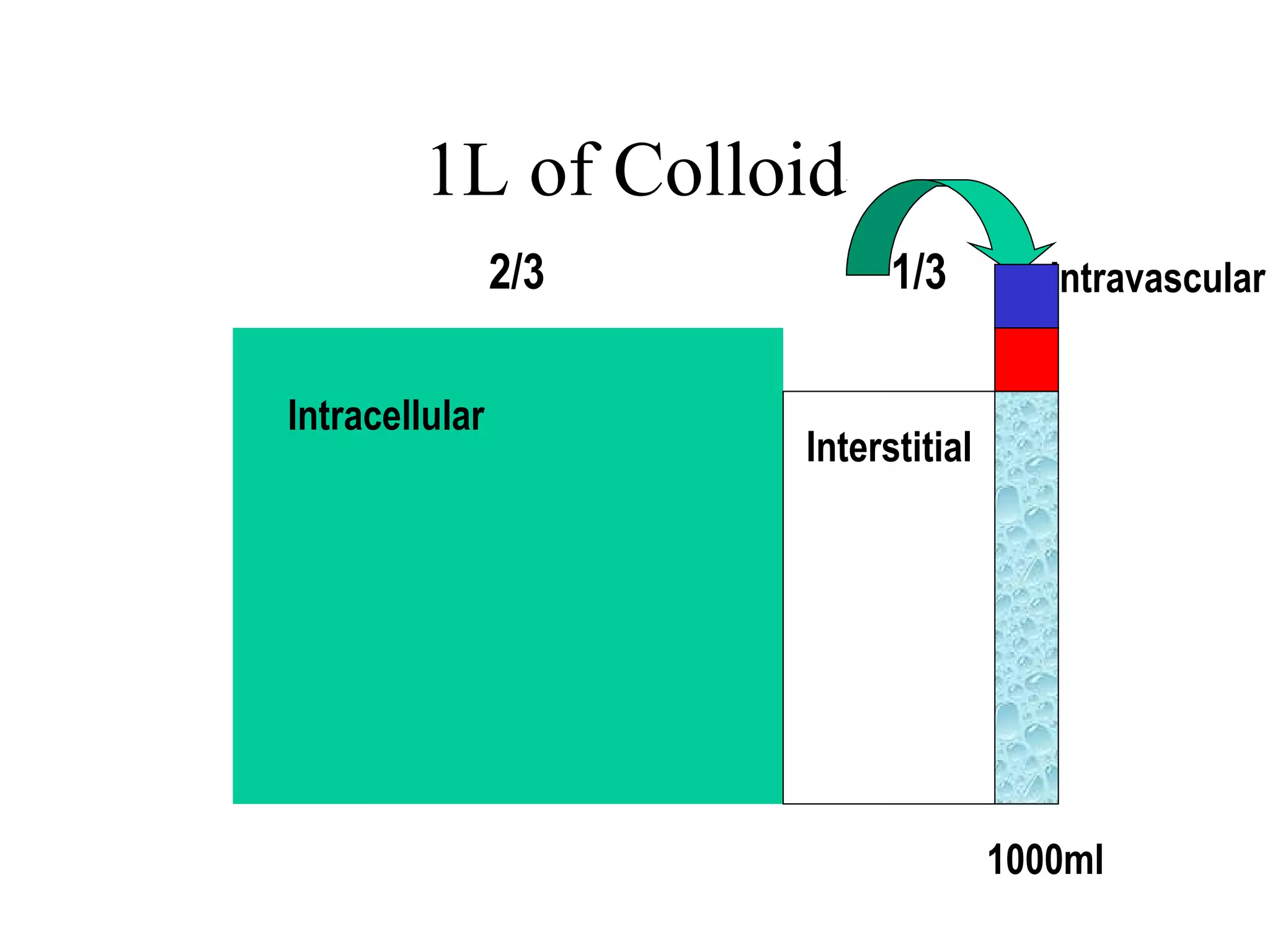 1L of Colloid
Intracellular
Interstitial
Intravascular2/3 1/3
1000ml
 