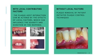 classification of periodontal diseases | PPTX
