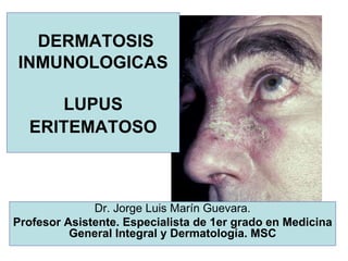DERMATOSIS
INMUNOLOGICAS
LUPUS
ERITEMATOSO
Dr. Jorge Luis Marín Guevara.
Profesor Asistente. Especialista de 1er grado en Medicina
General Integral y Dermatología. MSC
 