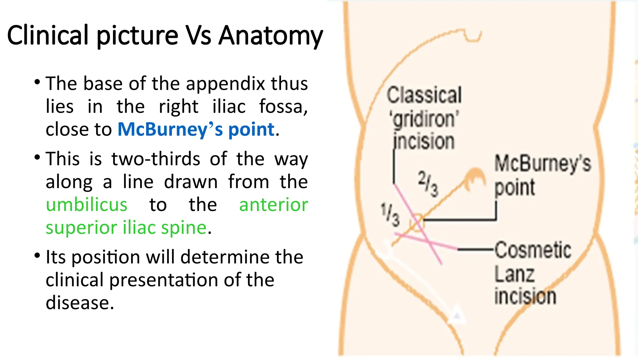 Clinical picture Vs Anatomy
• The base of the appendix thus
lies in the right iliac fossa,
close to McBurney’s point.
• This is two-thirds of the way
along a line drawn from the
umbilicus to the anterior
superior iliac spine.
• Its position will determine the
clinical presentation of the
disease.
 