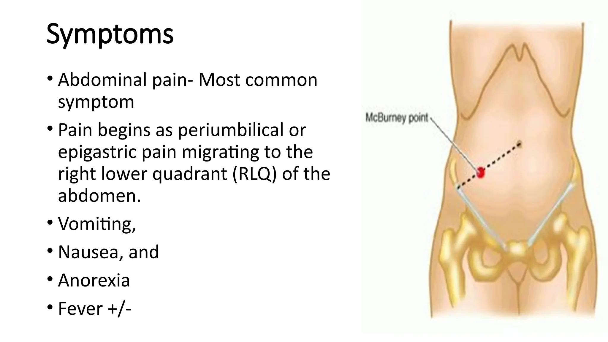 Symptoms
• Abdominal pain- Most common
symptom
• Pain begins as periumbilical or
epigastric pain migrating to the
right lower quadrant (RLQ) of the
abdomen.
• Vomiting,
• Nausea, and
• Anorexia
• Fever +/-
 