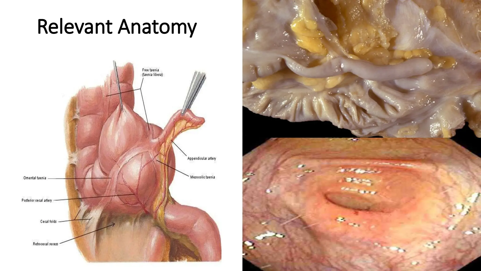 Relevant Anatomy
 