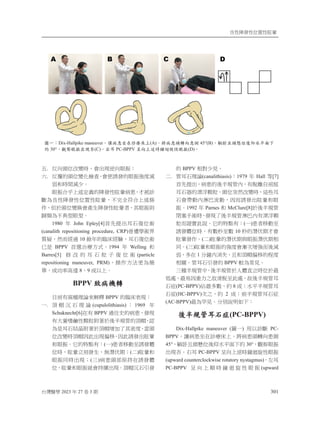 列⿏昋䘤⿏ỵ伖⿏䛑㘰
⎘䀋慓⬠ 2023 ⸜ 27 ⌟ 3 㛇 301
Ḽ.ġ ⍵⎹柕ỵ㓡嬲㗪炻㚫↢䎦微⎹䛤㋗烊
ℕ.ġ ⍵央䘬柕ỵ嬲⊾㩊㞍炻
㚫ἧ婀䘤䘬䛤㋗⻟⹎㷃
⻙␴㗪攻㷃⮹ˤ
䛤㋗⎰᷶ᶲ徘⭂佑䘬昋䘤⿏䛑㘰䕭か炻ㇵ塓姢
㕟䁢列⿏昋䘤⿏ỵ伖⿏䛑㘰炻ᶵ⬴ℐ䫎⎰ᶲ徘㡅
ẞ炻Ữ㕤柕ỵ嬲㎃㚫䓊䓇昋䘤⿏䛑㘰侭炻℞䛤㋗⇯
㬠栆䁢ᶵ℠✳䛤✳ˤ
1980 ⸜ John Epley[4]椾⃰㍸↢俛䞛⽑ỵ埻
(canalith repositioning procedure, CRP)㚦怕⬠埻䓴
岒䔹炻䃞侴䴻忶 10 检⸜䘬冐⸲䴻槿炻俛䞛⽑ỵ埻
⶚㗗 BPPV 椾怠㱣䗪㕡⺷ˤ1994 ⸜ Welling ␴
Barres[5] ᾖ 㓡 䘬 俛 䞛 䰺 ⫸ ⽑ ỵ 埻 (particle
repositioning maneuver, PRM)炻㑵ἄ㕡㱽㚜䁢䯉
╖炻ㆸ≇䌯檀忼 8ˣ9 ㆸẍᶲˤ
BPPV ठੰᐒᙯ
䚖⇵㚱ℑ䧖䎮婾Ἦ妋慳 BPPV 䘬冐⸲堐䎦烉
ᶨ.ġ 枪 ⷥ 㰱 䞛 䎮 婾 (cupulolithiasis) 烉 1969 ⸜
Schuknecht[6]⛐㚱 BPPV 忶⼨⎚䘬䕭か炻䘤䎦
㚱⣏慷▄渤⿏柮䰺旬叿㕤⼴⋲夷䭉䘬枪ⷥ炻娵
䁢㗗俛䞛䳸㘞旬叿㕤枪ⷥ⡆≈Ḯ℞⭮⹎炻䔞柕
ỵ㓡嬲㗪枪ⷥ⚈㬌↢䎦ῷ䦣炻⚈㬌婀䘤↢䛑㘰
␴䛤㋗ˤ⬫䘬䈡溆㚱烉(ᶨ)か侭䦣≽军婀䘤橼
ỵ㗪炻䛑㘰䩳⇣䘤䓇炻䃉㼃ặ㛇烊(Ḵ)䛑㘰␴
䛤㋗⎴㗪↢䎦烊(ᶱ)䕭か柕悐ᾅ㊩⛐婀䘤橼
ỵ炻䛑㘰␴䛤㋗⯙㚫㊩临↢䎦ˤ枪ⷥ㰱䞛⺽䘤
䘬 BPPV 䚠⮵⮹夳ˤ
Ḵ.ġ 䭉俛䞛䎮婾(canalithiasis)烉1979 ⸜ Hall 䫱[7]
椾⃰㍸↢炻䕭か䘬⼴⋲夷䭉ℏ炻㚱僓暊冒⇵⹕
俛䞛☐䘬㺪㴖柮䰺炻柕ỵ䨩䃞㓡嬲㗪炻忁ṃ俛
䞛㚫ⷞ≽ℏ㵳⶜㳩≽炻⚈侴婀䘤↢䛑㘰␴䛤
㋗ˤ1992 ⸜ Parnes ␴ McClure[8]㕤⼴⋲夷䭉
攱⠆ㇳ埻㗪炻䘤䎦Ḯ⼴⋲夷䭉㵳⶜ℏ㚱㺪㴖柮
䰺侴嫱⮎㬌婒ˤ⬫䘬䈡溆㚱烉(ᶨ)か侭䦣≽军
婀䘤橼ỵ㗪炻㚱㔠䥺军㔠 10 䥺䘬㼃ặ㛇ㇵ㚫
䛑㘰䘤ἄˤ(Ḵ)䛑㘰䘬㼃ặ㛇冯䛤㋗㼃ặ㛇䚠
⎴ˤ(ᶱ)䛑㘰␴䛤㋗䘬⻟⹎㚫㻠㫉⡆⻟侴⼴㷃
⻙炻⣂⛐ 1 ↮揀ℏ㴰⣙炻ᶼ␴枪ⷥῷ䦣䘬䦳⹎
䚠斄ˤ䭉俛䞛⺽䘤䘬 BPPV 庫䁢ⷠ夳ˤ
ᶱ䧖⋲夷䭉ᷕ炻⼴⋲夷䭉㕤Ṣ橼䚜䩳㗪ỵ㕤㚨
Ỷ嗽炻㚨㖻⚈慵≃ᷳ㓭㹹僓军㬌嗽炻㓭⼴⋲夷䭉俛
䞛䕯(PC-BPPV)Ỽ㚨⣂㔠炻䲬 8 ㆸ烊㯜⸛⋲夷䭉俛
䞛䕯(HC-BPPV)㫉ᷳ炻䲬 2 ㆸ烊⇵⋲夷䭉俛䞛䕯
(AC-BPPV)㚨䁢份夳ˤ↮⇍婒㖶⤪ᶳ烉
ࡕъೕᆅԸҡੱ(PC-BPPV)
Dix-Hallpike maneuver (⚾ᶨ) 䓐ẍ姢㕟 PC-
BPPV炻嬻䕭か⛸⛐姢䗪⸲ᶲ炻⮯䕭か柕廱⎹か“
45°炻幢⌏ᶼ柕ㆠỵ⼴ẘ㯜⸛朊ᶳ䲬 30°炻奨⮇䛤㋗
↢䎦⏎ˤ⎛俛 PC-BPPV ⏰⎹ᶲ微㗪揀徜㕳⿏䛤㋗
(upward counterclockwise rotatory nystagmus)炻ⶎ俛
PC-BPPV ⏰ ⎹ ᶲ 枮 㗪 揀 徜 㕳 ⿏ 䛤 ㋗ (upward
კ΋ǺDix-Hallpike maneuverǶᡣੰ஻֤ӧບᕍ‫׉‬΢(A)Ǵஒੰ஻ᓐᙯӛ஻ୁ 45°(B)Ǵ፴㣺ЪᓐᝌՏࡕһНѳय़Π
ऊ 30°Ǵᢀჸ౳ਁр౜ց(C)ǶѓԸ PC-BPPV ևӛ΢଍ਔដ଑௽‫܄‬౳ਁ(D)Ƕ
 